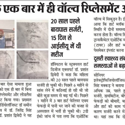 Article on TAVR